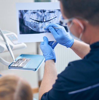 What is Accelerated Orthodontics?