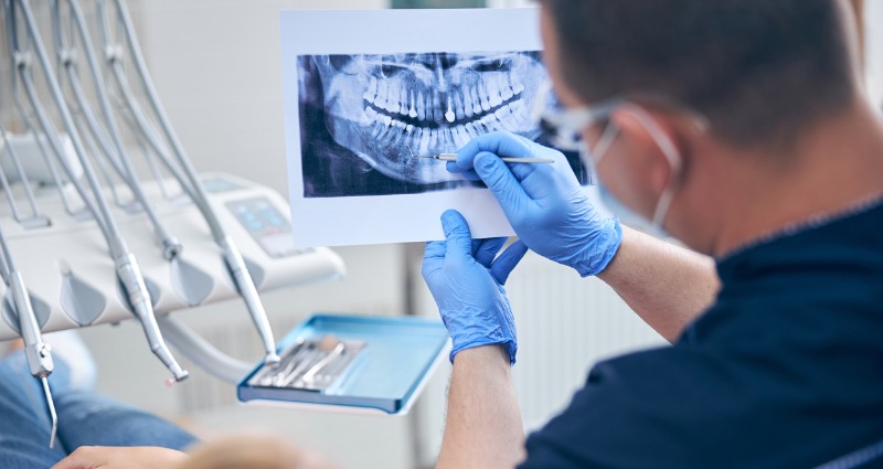 A dentist holding up a patient’s mouth x-ray while explaining how he’ll perform accelerated orthodontics.