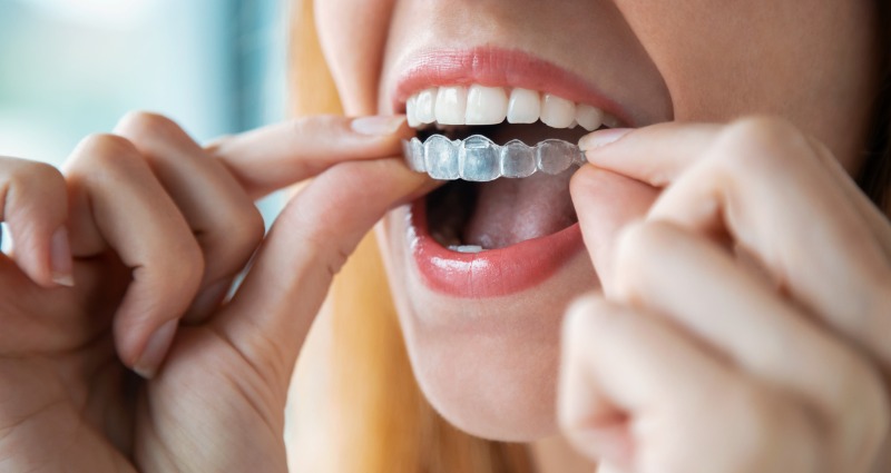 A woman taking her retainers out of her mouth