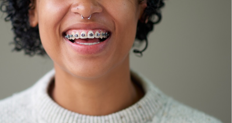 Young woman with braces smiling at the camera