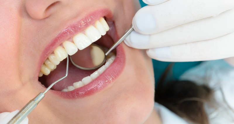 Dental examination examination to determine gingivitis in young female patient