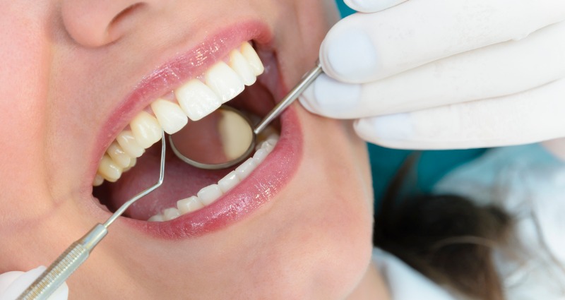 Broken Braces? What to do if a Bracket or Wire Breaks (Don't Panic!)