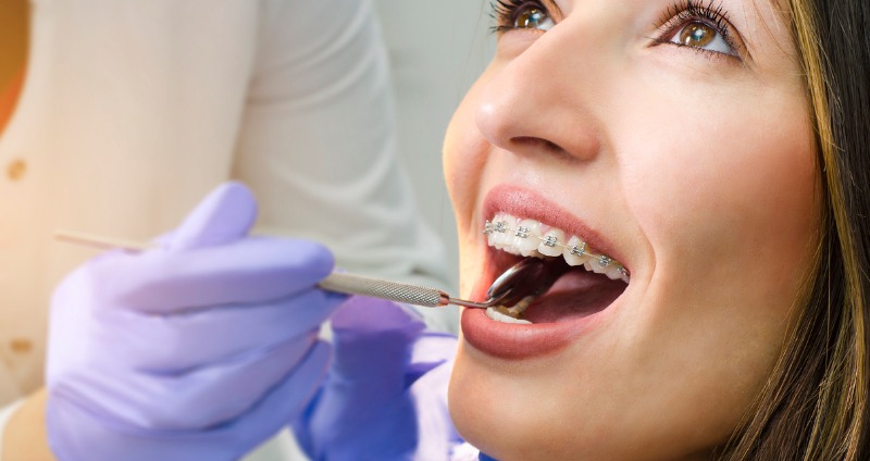 A woman having her orthodontic braces checked