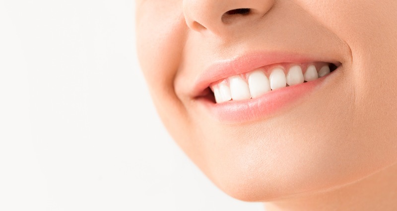 A beautiful female smile after braces fixed her overbite.