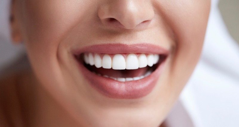 Close up of young womans beautiful smile after her orthodontics braces journey