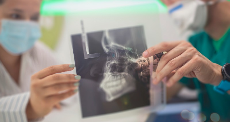 Two surgeons holding up an xray of a patient’s jaw to assess them for jaw surgery.