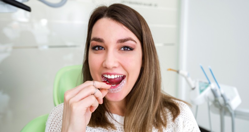 young woman holding an invisalign aligner