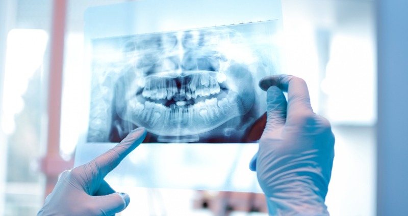 An Orthodontist holding an x-ray of a patients jaw and teeth. 